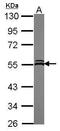 Vacuolar Protein Sorting 4 Homolog A antibody, PA5-30528, Invitrogen Antibodies, Western Blot image 