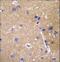 ATP Binding Cassette Subfamily C Member 12 antibody, LS-C155847, Lifespan Biosciences, Immunohistochemistry frozen image 