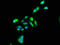 TNFAIP3 Interacting Protein 1 antibody, LS-C670285, Lifespan Biosciences, Immunofluorescence image 