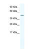 Ligand Dependent Nuclear Receptor Corepressor Like antibody, MBS834354, MyBioSource, Western Blot image 