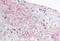 Zinc Finger And BTB Domain Containing 2 antibody, MBS243917, MyBioSource, Immunohistochemistry frozen image 