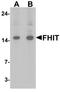 Fragile Histidine Triad Diadenosine Triphosphatase antibody, TA326647, Origene, Western Blot image 