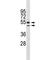 Vitamin D Receptor antibody, F46490-0.4ML, NSJ Bioreagents, Western Blot image 