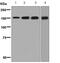 Carbamoyl-Phosphate Synthase 1 antibody, ab129076, Abcam, Western Blot image 