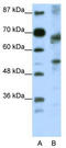 Transcription Factor 12 antibody, TA343369, Origene, Western Blot image 