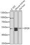 Erythropoietin Receptor antibody, GTX32590, GeneTex, Western Blot image 