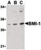 BMI1 Proto-Oncogene, Polycomb Ring Finger antibody, PA5-20223, Invitrogen Antibodies, Western Blot image 