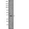 Thioredoxin-related transmembrane protein 2 antibody, abx219023, Abbexa, Western Blot image 