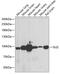 GLI Family Zinc Finger 2 antibody, 22-276, ProSci, Western Blot image 