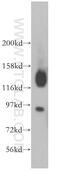 Vezatin, Adherens Junctions Transmembrane Protein antibody, 17684-1-AP, Proteintech Group, Western Blot image 