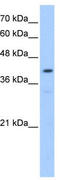 Protein O-Mannosyltransferase 2 antibody, TA341918, Origene, Western Blot image 
