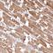 Inositol Polyphosphate-4-Phosphatase Type II B antibody, NBP1-85883, Novus Biologicals, Immunohistochemistry frozen image 