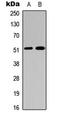 Coagulation factor IX antibody, LS-C354366, Lifespan Biosciences, Western Blot image 