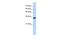 C1q And TNF Related 4 antibody, A17153, Boster Biological Technology, Western Blot image 