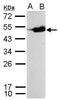 Cp27 antibody, PA5-34954, Invitrogen Antibodies, Western Blot image 