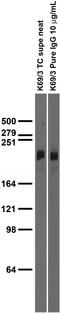 Sodium Voltage-Gated Channel Alpha Subunit 2 antibody, 73-024, Antibodies Incorporated, Western Blot image 