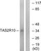 Taste 2 Receptor Member 10 antibody, GTX87250, GeneTex, Western Blot image 