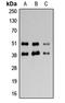 Adenosine receptor A3 antibody, LS-C358897, Lifespan Biosciences, Western Blot image 