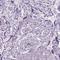 Marginal Zone B And B1 Cell Specific Protein antibody, HPA052694, Atlas Antibodies, Immunohistochemistry frozen image 