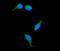 Transient Receptor Potential Cation Channel Subfamily M Member 8 antibody, M01002, Boster Biological Technology, Immunofluorescence image 