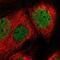 Spermatogenesis Associated 20 antibody, NBP1-82147, Novus Biologicals, Immunocytochemistry image 
