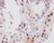 Nucleoporin 98 antibody, M01301, Boster Biological Technology, Immunohistochemistry paraffin image 