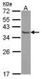 E2F-binding site-modulating activity protein antibody, GTX114373, GeneTex, Western Blot image 