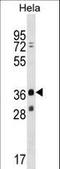 MAGE Family Member B16 antibody, LS-C163970, Lifespan Biosciences, Western Blot image 