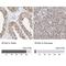 Splicing factor 3A subunit 3 antibody, NBP2-38200, Novus Biologicals, Immunohistochemistry paraffin image 