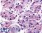 Solute Carrier Family 7 Member 11 antibody, LS-A3434, Lifespan Biosciences, Immunohistochemistry paraffin image 