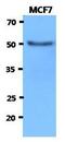 Hexosaminidase Subunit Alpha antibody, GTX53726, GeneTex, Western Blot image 