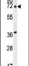 Acyl-CoA Thioesterase 11 antibody, PA5-23639, Invitrogen Antibodies, Western Blot image 