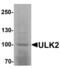 Unc-51 Like Autophagy Activating Kinase 2 antibody, LS-B10105, Lifespan Biosciences, Western Blot image 