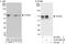 Forkhead Box N3 antibody, A303-620A, Bethyl Labs, Immunoprecipitation image 