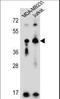 p58 NK receptor CL-43 antibody, LS-C165526, Lifespan Biosciences, Western Blot image 