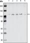 EPH Receptor B1 antibody, MA5-15385, Invitrogen Antibodies, Western Blot image 