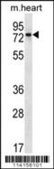 PARP2 antibody, 56-362, ProSci, Western Blot image 