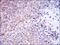 DT-diaphorase antibody, GTX60523, GeneTex, Immunohistochemistry paraffin image 