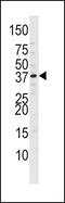 Cyclin Dependent Kinase 7 antibody, PA5-12573, Invitrogen Antibodies, Western Blot image 