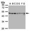 Gamma-aminobutyric acid receptor subunit beta-1 antibody, LS-B4834, Lifespan Biosciences, Western Blot image 