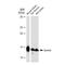 Baculoviral IAP Repeat Containing 5 antibody, GTX01538, GeneTex, Western Blot image 