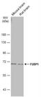 Far Upstream Element Binding Protein 1 antibody, NBP2-16543, Novus Biologicals, Western Blot image 