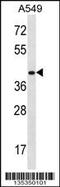Homeobox D11 antibody, 58-287, ProSci, Western Blot image 