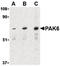 P21 (RAC1) Activated Kinase 6 antibody, LS-C19474, Lifespan Biosciences, Western Blot image 