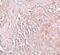 Solute Carrier Family 39 Member 8 antibody, PA5-21073, Invitrogen Antibodies, Immunohistochemistry paraffin image 