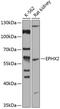 Epoxide Hydrolase 2 antibody, 15-424, ProSci, Western Blot image 