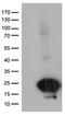 SCP2 Sterol Binding Domain Containing 1 antibody, LS-C796472, Lifespan Biosciences, Western Blot image 