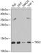 Thioredoxin 2 antibody, GTX33563, GeneTex, Western Blot image 