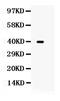 Tribbles Pseudokinase 2 antibody, PB9900, Boster Biological Technology, Western Blot image 