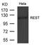 RE1 Silencing Transcription Factor antibody, A03852, Boster Biological Technology, Western Blot image 
